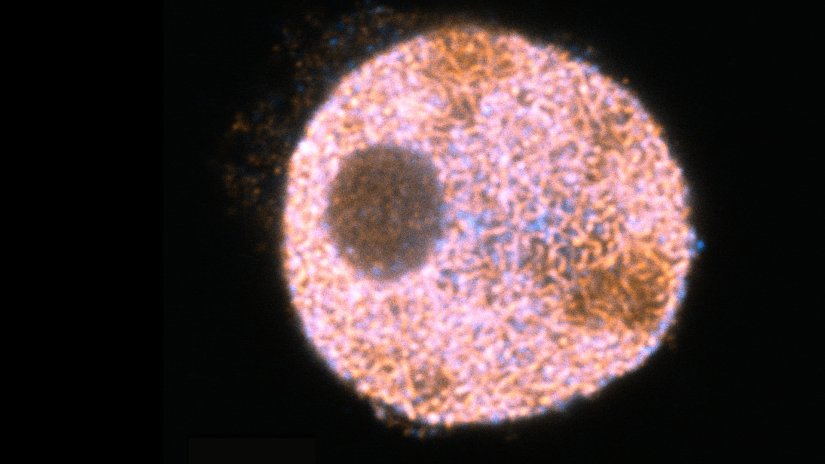 Confocal and STED image of a meiotic cell of Chinese spring wheat stained for two synaptonemal complex components. Sample courtesy: Sepsi Adél, HUN-REN, Centre for Agricultural Research, Martonvásár, Hungary.