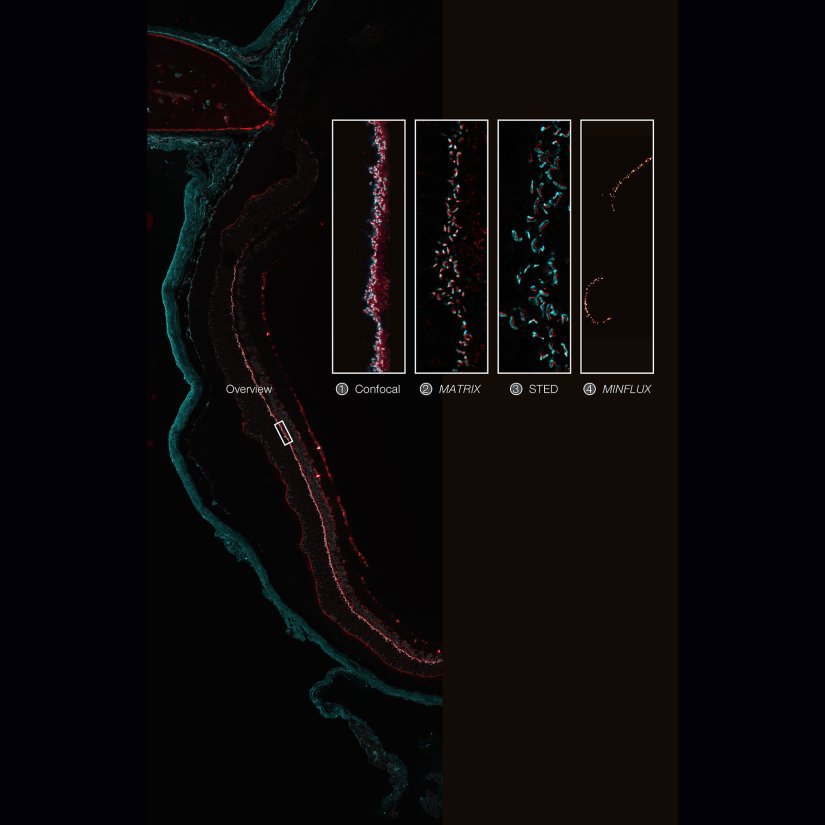 Imaging across scales from diffraction-limited to molecular resolution: ribbon synapses in fixed mouse retina tissue stained for VAMP1 (abberior STAR RED) and CtBP2 (abberior STAR ORANGE) (confocal, MATRIX, STED) or for Bassoon (MINFLUX).