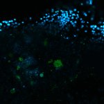 Herpes viral particlesHuman cytomegalovirus particles in infected human foreskin fibroblasts, labeled for a viral glycoprotein (abberior STAR RED, blue) and a tegument protein (abberior STAR 580, green). The sample was 4x gel-expanded and imaged with STED.