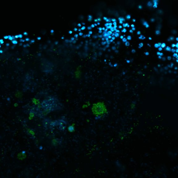 Herpes viral particlesHuman cytomegalovirus particles in infected human foreskin fibroblasts, labeled for a viral glycoprotein (abberior STAR RED, blue) and a tegument protein (abberior STAR 580, green). The sample was 4x gel-expanded and imaged with STED.