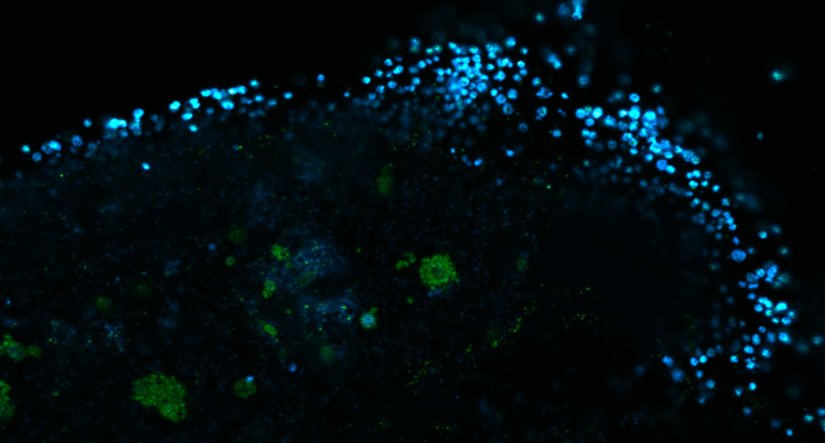 Human cytomegalovirus particles in infected human foreskin fibroblasts, labeled for a viral glycoprotein (abberior STAR RED, blue) and a tegument protein (abberior STAR 580, green). The sample was 4x gel-expanded and imaged with STED.
