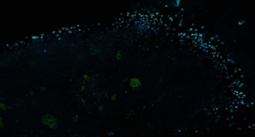 Human cytomegalovirus particles in infected human foreskin fibroblasts, labeled for a viral glycoprotein (abberior STAR RED, blue) and a tegument protein (abberior STAR 580, green). The sample was 4x gel-expanded and imaged with STED.