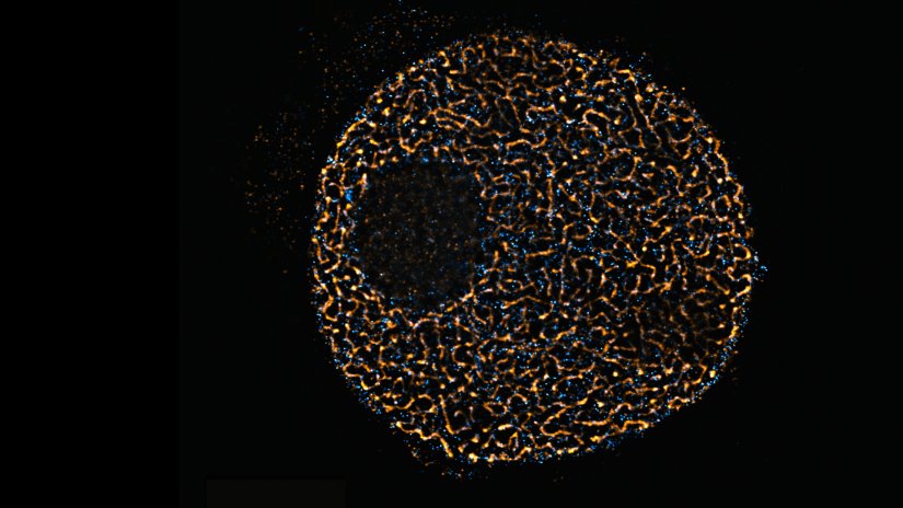 Confocal and STED image of a meiotic cell of Chinese spring wheat stained for two synaptonemal complex components. Sample courtesy: Sepsi Adél, HUN-REN, Centre for Agricultural Research, Martonvásár, Hungary.