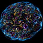 SpheroidConfocal stitched image of a spheroid stained for nuclear pores (magenta), actin cytoskeleton (blue) and mitochondria (orange).NIH-313 spheroid, fixed with 4% PFA, kindly provided by ibidi and prepared on μ-Slide VI 0.4 μ-Pattern ibiTreat.