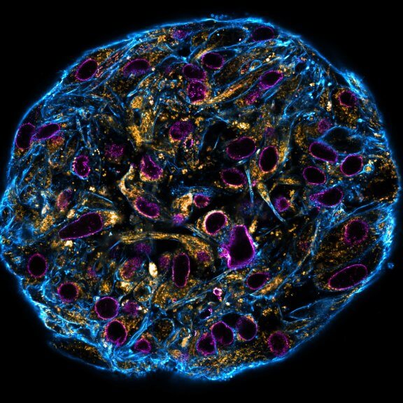 SpheroidConfocal stitched image of a spheroid stained for nuclear pores (magenta), actin cytoskeleton (blue) and mitochondria (orange).NIH-313 spheroid, fixed with 4% PFA, kindly provided by ibidi and prepared on μ-Slide VI 0.4 μ-Pattern ibiTreat.