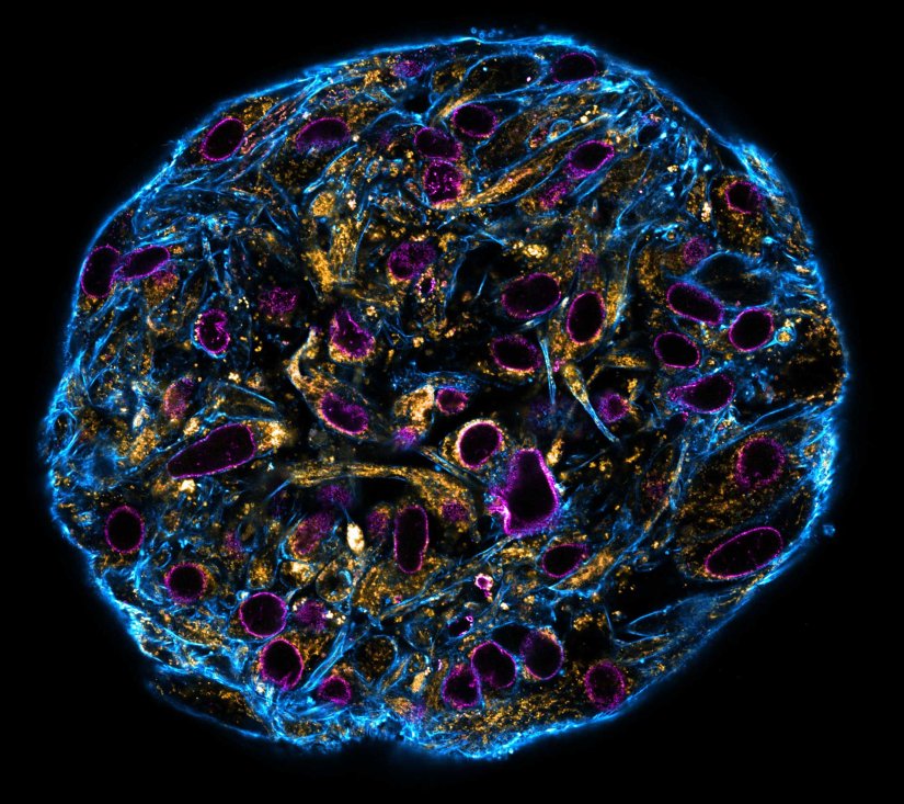 SpheroidConfocal stitched image of a spheroid stained for nuclear pores (magenta), actin cytoskeleton (blue) and mitochondria (orange).NIH-313 spheroid, fixed with 4% PFA, kindly provided by ibidi and prepared on μ-Slide VI 0.4 μ-Pattern ibiTreat.