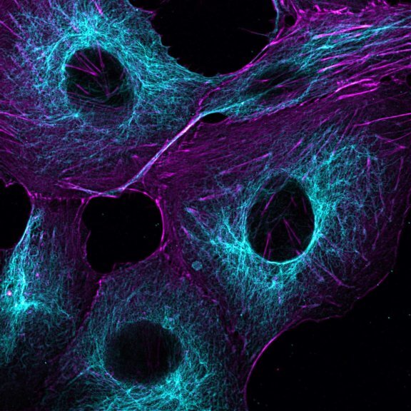 Cells actin vimentin_MATRIXMammalian cells stained for actin (purple, abberior STAR RED) and vimentin (cyan, abberior LIVE 460L). Differential detection with the MATRIX array detector was used to improve resolution, optical sectioning, and signal-to-background-ratio.