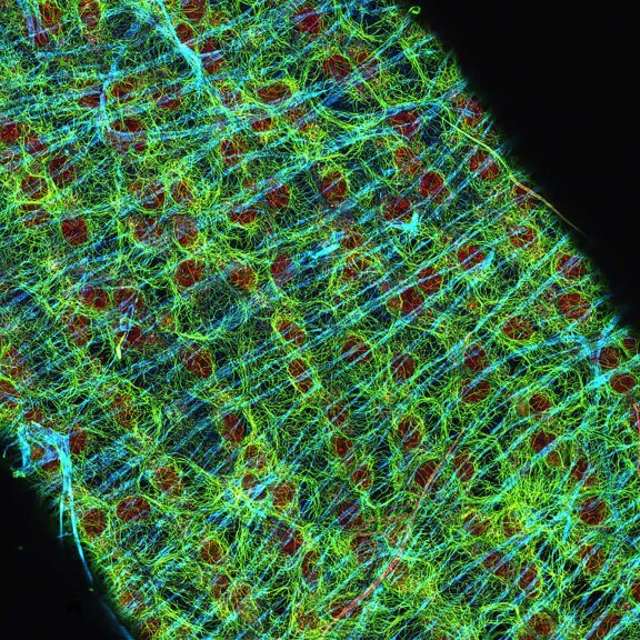 Drosophila egg in ovaryDrosophila egg in the ovary stained for tubulin (green, abberior STAR RED), actin (blue, abberior STAR GREEN), and DNA (red, abberior LIVE 590). 