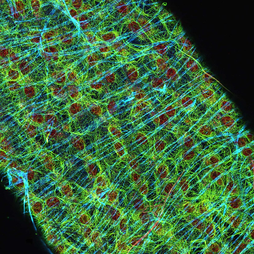 Drosophila egg in ovaryDrosophila egg in the ovary stained for tubulin (green, abberior STAR RED), actin (blue, abberior STAR GREEN), and DNA (red, abberior LIVE 590). 