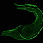 ExM STED Trypanosoma_with zoomThe protozoan Trypanosoma, fixed and three-fold expanded, was stained for tubulin, imaged with STED, and deconvolved with TRUESHARP image boosting. The combination of expansion and STED provides a resolution at which the four tubulin fibers of the flagellum are clearly visible. Scale bar refers to expanded specimen.Sample courtesy: Mélanie Bonhivers, Laboratoire de Microbiologie Fondamentale et Pathogénicité, CNRS / Université Bordeaux, France