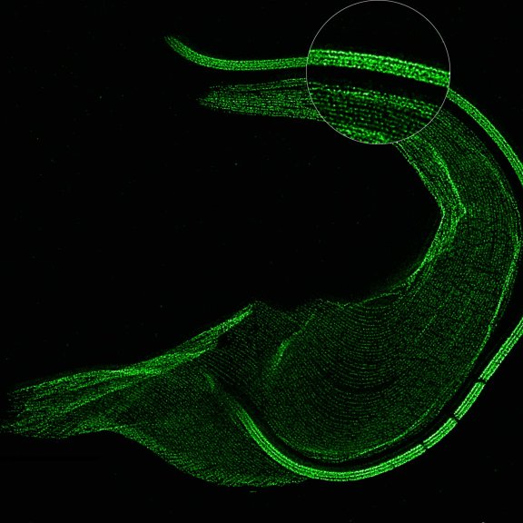 ExM STED Trypanosoma_with zoomThe protozoan Trypanosoma, fixed and three-fold expanded, was stained for tubulin, imaged with STED, and deconvolved with TRUESHARP image boosting. The combination of expansion and STED provides a resolution at which the four tubulin fibers of the flagellum are clearly visible. Scale bar refers to expanded specimen.Sample courtesy: Mélanie Bonhivers, Laboratoire de Microbiologie Fondamentale et Pathogénicité, CNRS / Université Bordeaux, France