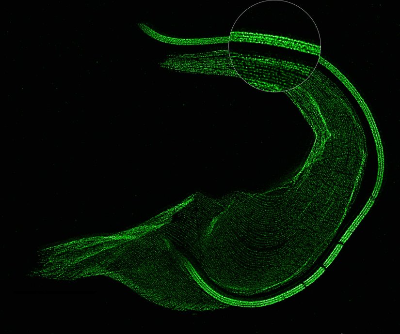 ExM STED Trypanosoma_with zoomThe protozoan Trypanosoma, fixed and three-fold expanded, was stained for tubulin, imaged with STED, and deconvolved with TRUESHARP image boosting. The combination of expansion and STED provides a resolution at which the four tubulin fibers of the flagellum are clearly visible. Scale bar refers to expanded specimen.Sample courtesy: Mélanie Bonhivers, Laboratoire de Microbiologie Fondamentale et Pathogénicité, CNRS / Université Bordeaux, France
