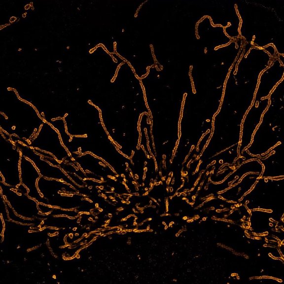 Video of mitochondria in living U2OS cells imaged for 1.5 hours with STED and deconvolved with TRUESHARP image boosting.