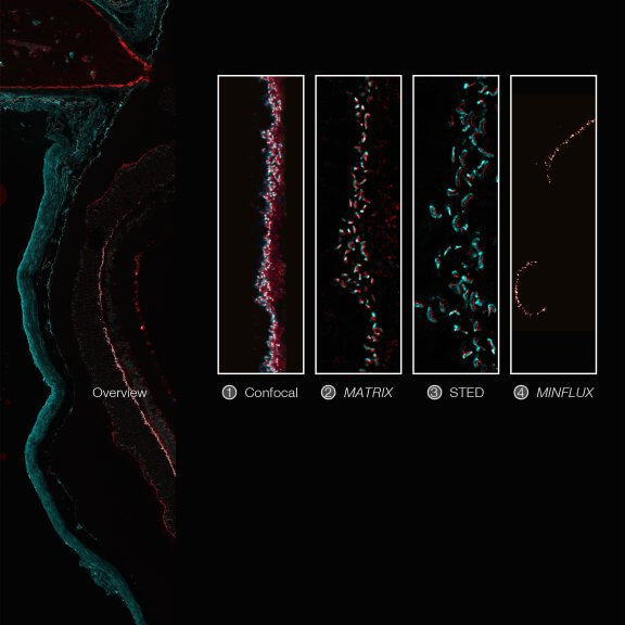 Imaging across scales from diffraction-limited to molecular resolution: ribbon synapses in fixed mouse retina tissue stained for VAMP1 (abberior STAR RED) and CtBP2 (abberior STAR ORANGE) (confocal, MATRIX, STED) or for Bassoon (MINFLUX).