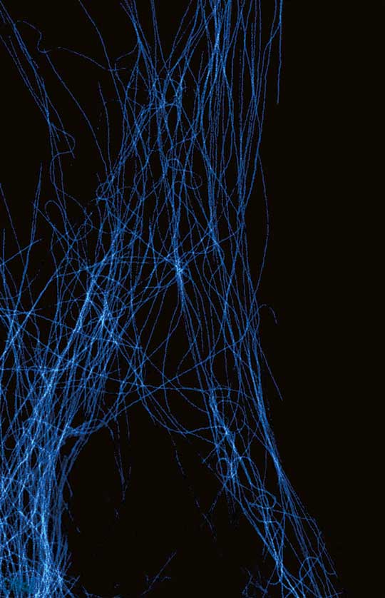 Explanation of the FLEXPOSURE operating principle using tubulin as an example