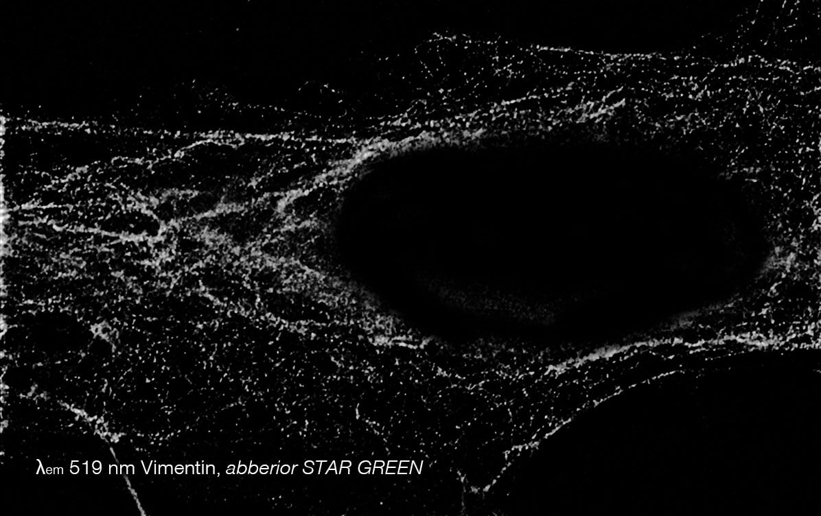 5-color STED image, Vimentin channel