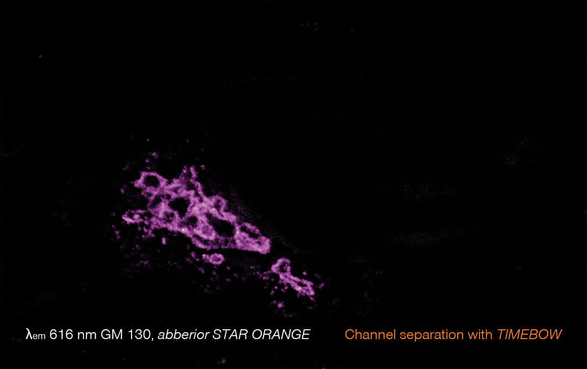 5-color STED image, GM 130 channel, TIMEBOW separation