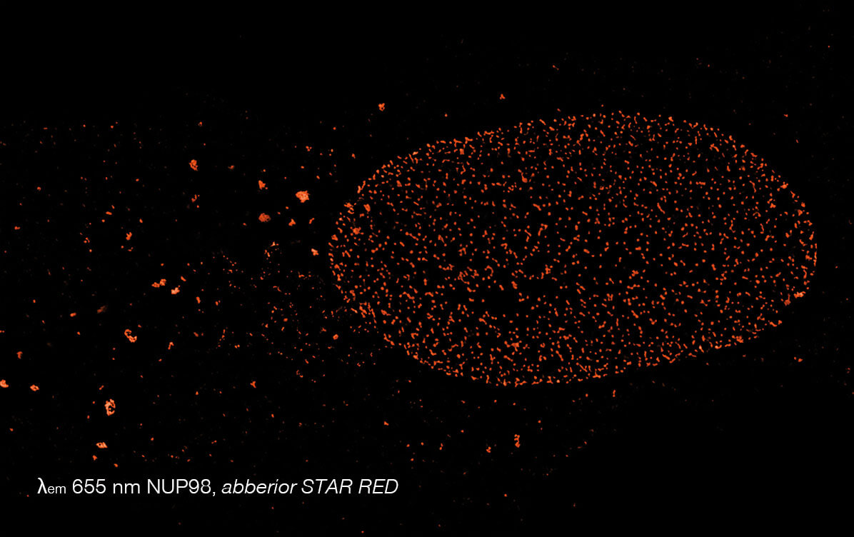 5-color STED image, NUP98 channel