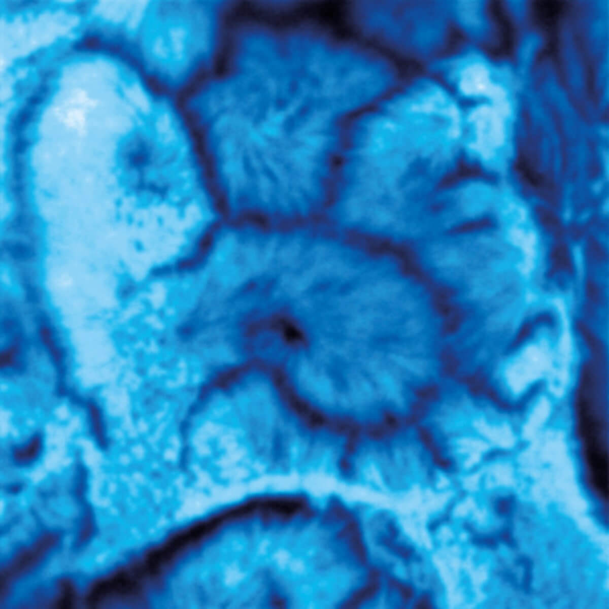 CaCo2 cells confocal image