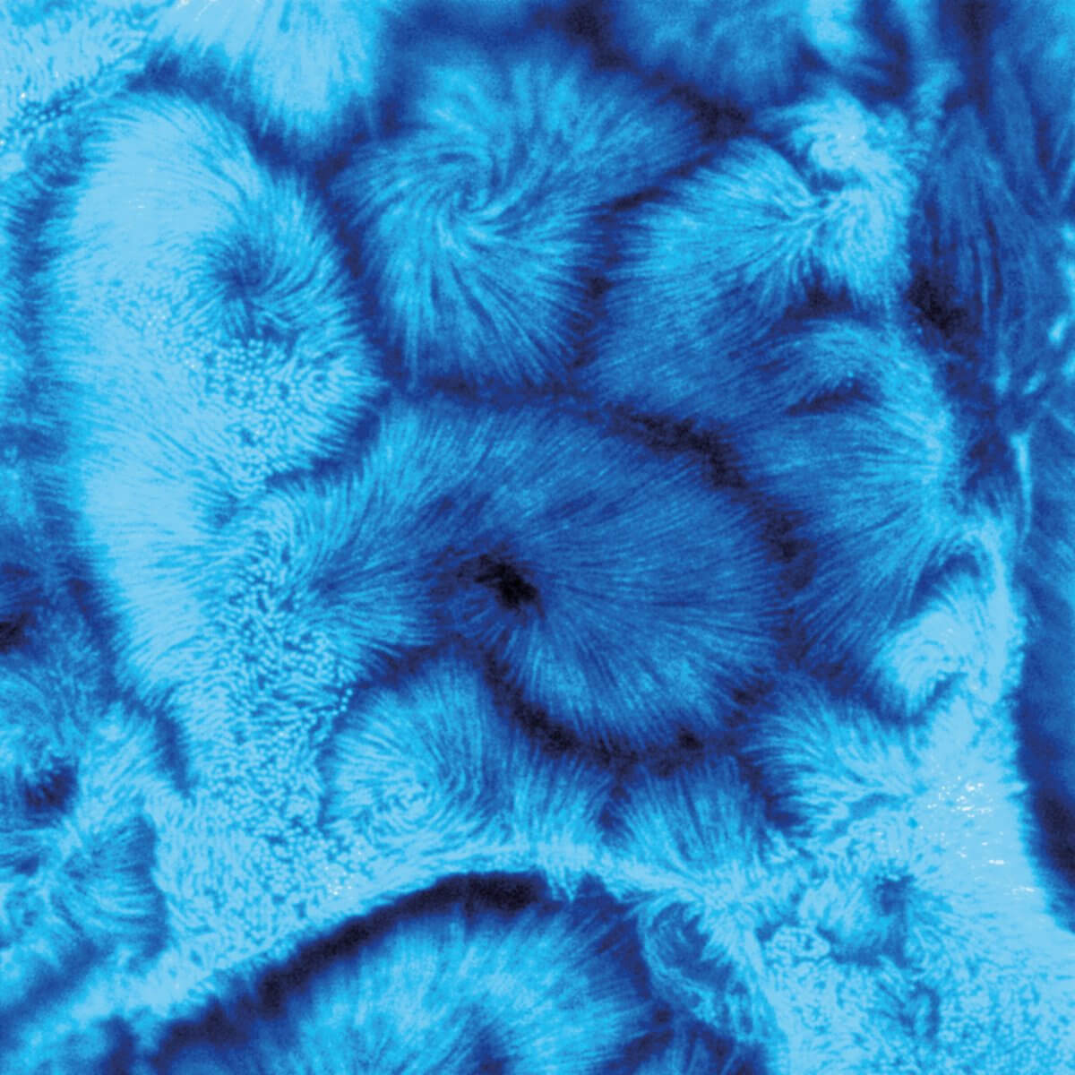 CaCo2 cells STED image