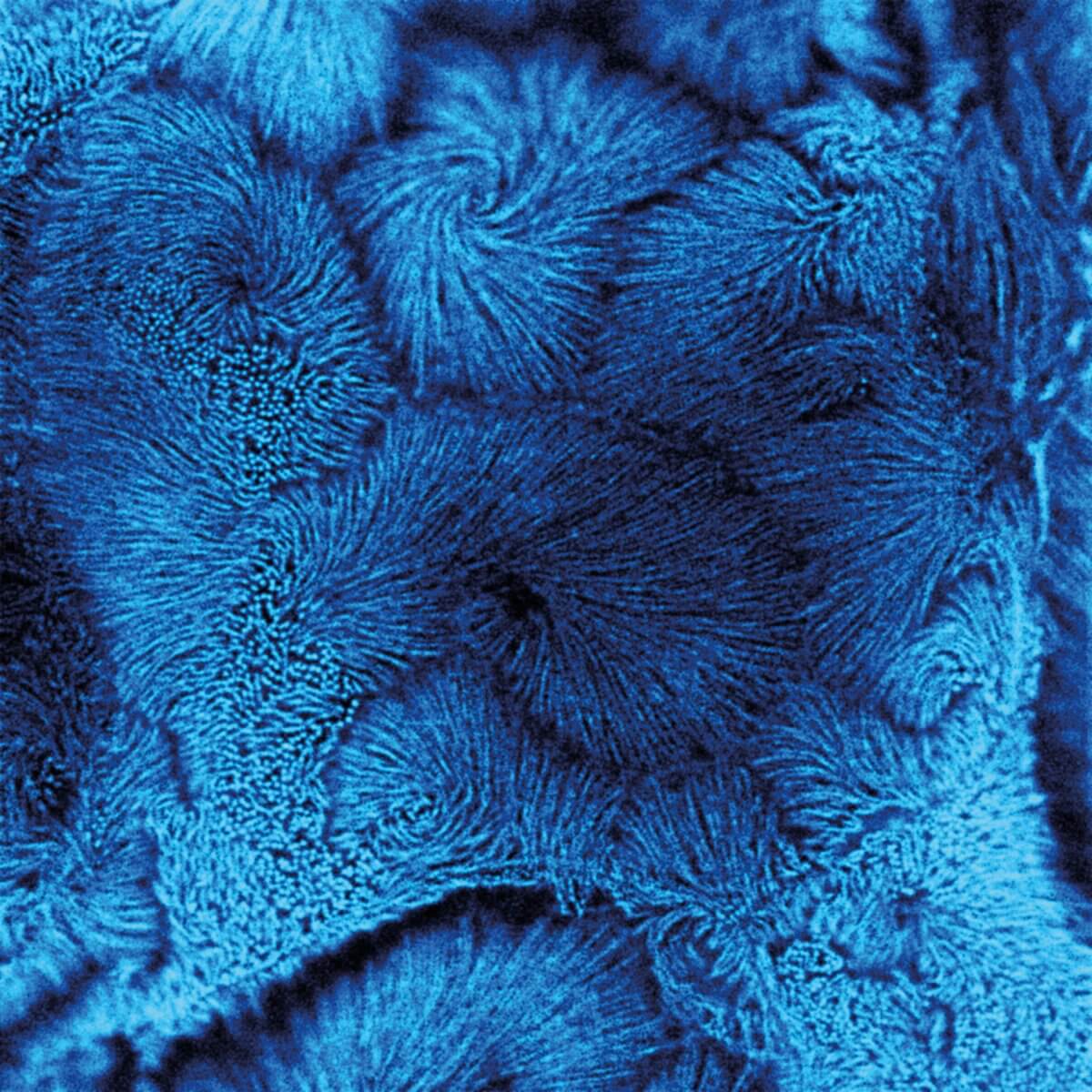 CaCo2 cells TIMEBOW+MATRIX+STED image