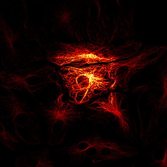 Cells with cytoskeleton visualized in red