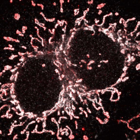 Confocal image of cultured mammalian cell immunostained for an inner and outer mitochondrial membrane marker.