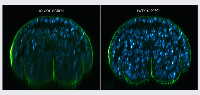 Comparison of deep tissue imaging with and without RAYSHAPE aberration correction. The left image shows an xz section of a stage 17 Drosophila embryo without aberration correction - the image becomes dark and murky with increasing imaging depth. The right image shows the same section imaged with RAYSHAPE, which yields a bright and crisp image from top to bottom.