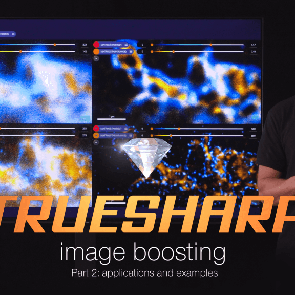 TRUESHARP image boosting or how abberior deals with noise and background part 2: applications and examples.
